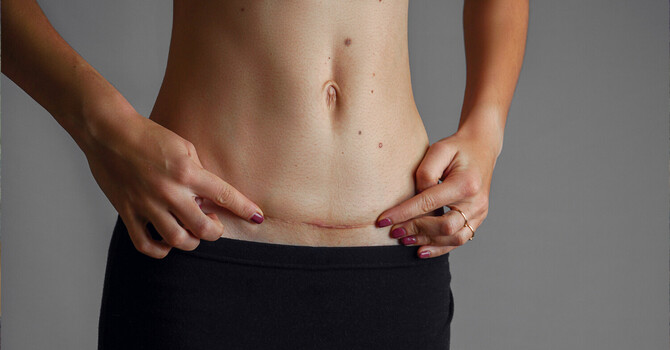 Why Healing Takes Longer Than You’ve Been Told